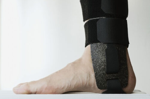 Woodcast is a lightweight biodegradable material made from wood and biopolymers, originally developed to replace the plaster casts traditionally used in hospitals.