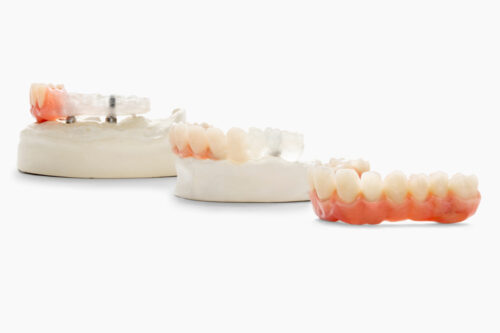 Moi Composites reachs an important milestone in the adoption of continuous fiber 3D printing in the dental field